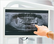 Digital Xrays